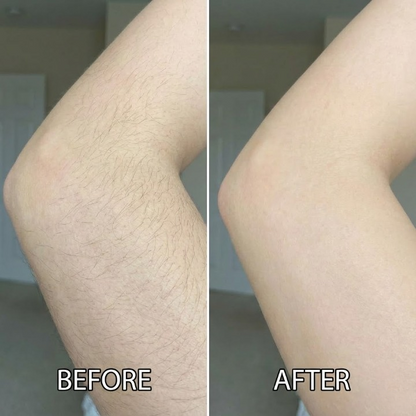 Gleam™ Natural Hair Reduction Oil