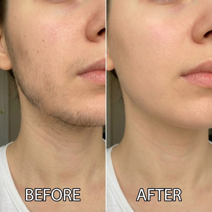 Gleam™ Natural Hair Reduction Oil